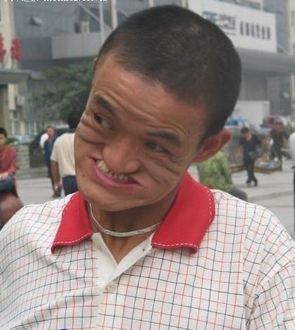 太绝了！奇人自咬鼻子全过程,看的我有点晕~~