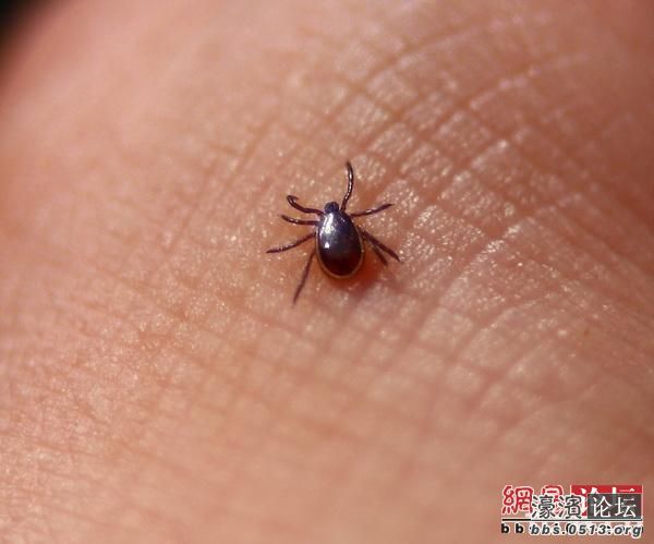 蜱虫叮人.jpg